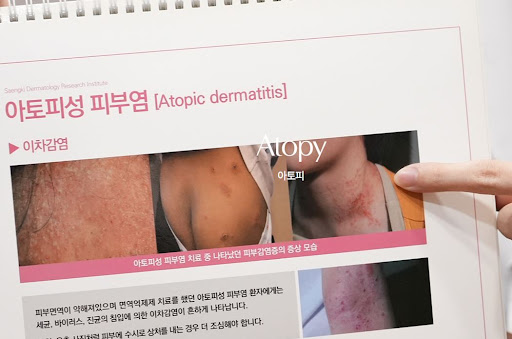 생기한의원으로 보는 아토피 증상과 생활환경 연관 기본 정보